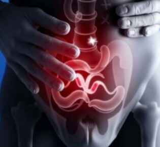 Atypical Appendicitis Symptoms: What You Need to Know Beyond the Classic Signs