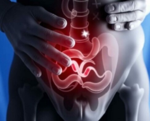 Atypical Appendicitis Symptoms: What You Need to Know Beyond the Classic Signs