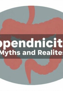 Appendicite : Mythes et Réalités dévoilés