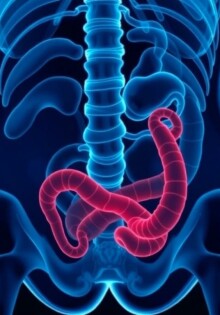 Apéndice en movimiento: apendicitis en deportistas, retos diagnósticos y protocolos seguros para volver a la competición