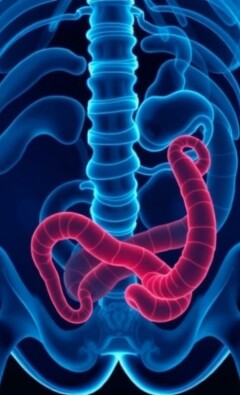 Apéndice en movimiento: apendicitis en deportistas, retos diagnósticos y protocolos seguros para volver a la competición