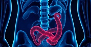 Apéndice en movimiento: apendicitis en deportistas, retos diagnósticos y protocolos seguros para volver a la competición