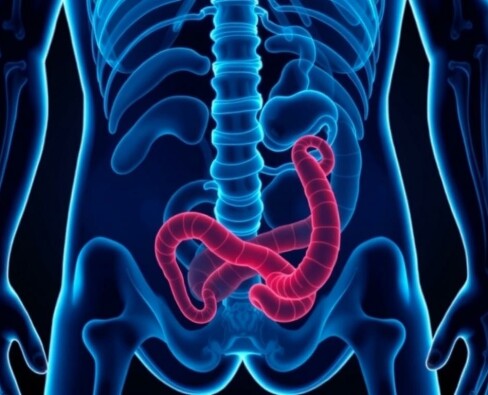 Apéndice en movimiento: apendicitis en deportistas, retos diagnósticos y protocolos seguros para volver a la competición