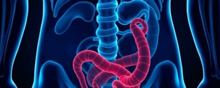 Apéndice en movimiento: apendicitis en deportistas, retos diagnósticos y protocolos seguros para volver a la competición