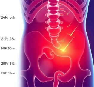 Understanding CRP Levels in Appendicitis: What They Reveal About Your Health
