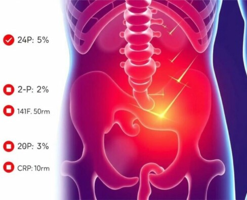 Understanding CRP Levels in Appendicitis: What They Reveal About Your Health