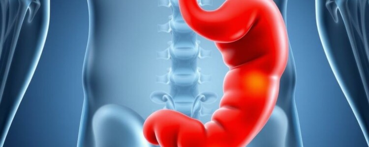 La modélisation du riesgo individual de desarrollar una apendicitis: cómo pensar, medir y predecir lo inesperado
