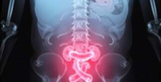 Understanding the Role of X-rays in Diagnosing Appendicitis