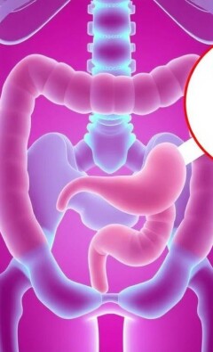 Appendicite et Constipation : Un Lien Méconnu