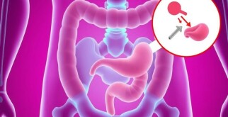 Appendicite et Constipation : Un Lien Méconnu