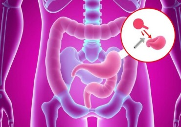 Appendicite et Constipation : Un Lien Méconnu