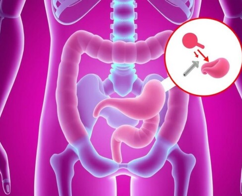 Appendicite et Constipation : Un Lien Méconnu