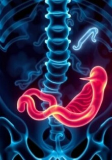 Understanding Appendicitis and Fever: Causes, Symptoms, and When to Seek Help