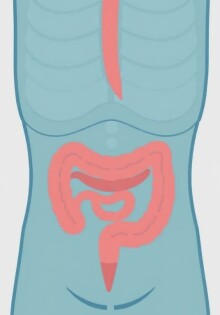 Cómo crear una hoja informativa sobre apendicitis para escuelas: guía práctica y lista de verificación