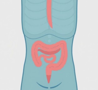 Cómo crear una hoja informativa sobre apendicitis para escuelas: guía práctica y lista de verificación