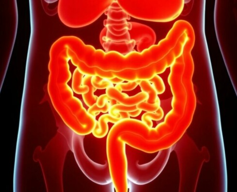 Blinddarm und chronisch-entzündliche Darmerkrankungen: Ein faszinierender Einblick in Ursachen, Zusammenhänge und Behandlungsansätze