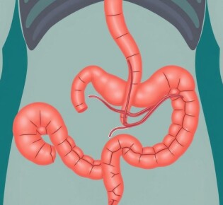 Understanding Appendicitis and Fistula Formation: What You Need to Know