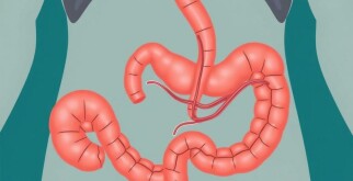 Understanding Appendicitis and Fistula Formation: What You Need to Know