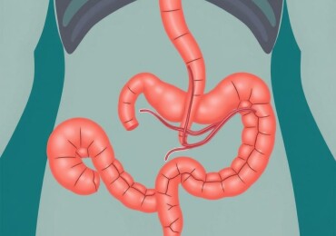 Understanding Appendicitis and Fistula Formation: What You Need to Know