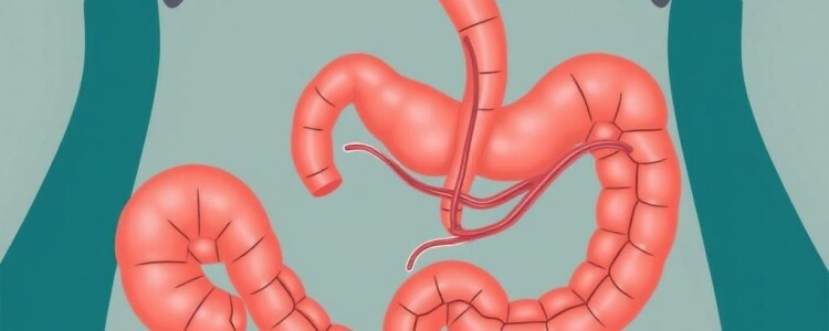 Understanding Appendicitis and Fistula Formation: What You Need to Know