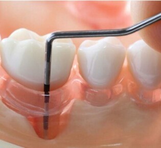 Что такое синдром пустого турецкого седла: причины, симптомы и лечение