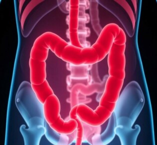 Appendicitis Without Surgery: Is It Possible?