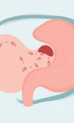 Understanding Wound Infection After Appendectomy: Causes, Prevention, and Care