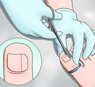 Холангиохолецистит: что это такое и как с ним бороться