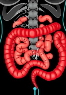 Apendicitis en mujeres: cómo distinguirla de los problemas ginecológicos y no perder tiempo