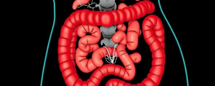 Apendicitis en mujeres: cómo distinguirla de los problemas ginecológicos y no perder tiempo