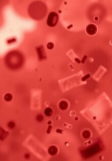 Sepsis o septicemia: una complicación grave que hay que conocer