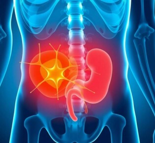 Das Leitsymptom: Bauchschmerzen bei Appendizitis — ¿Por qué este dolor merece toda tu atención?