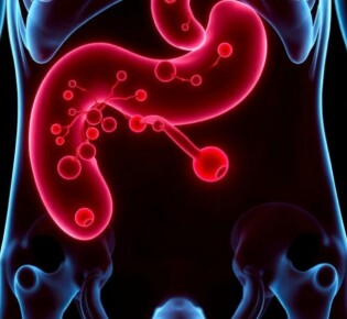 La revolución silenciosa: el papel de los biomarcadores en mejorar el diagnóstico de la apendicitis