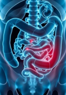 Wiederkehrende Bauchschmerzen nach Appendektomie: Ursachen, Diagnose und Behandlungsmöglichkeiten