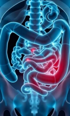 Wiederkehrende Bauchschmerzen nach Appendektomie: Ursachen, Diagnose und Behandlungsmöglichkeiten