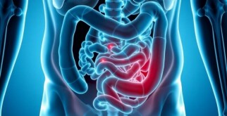 Wiederkehrende Bauchschmerzen nach Appendektomie: Ursachen, Diagnose und Behandlungsmöglichkeiten