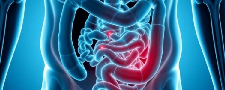 Wiederkehrende Bauchschmerzen nach Appendektomie: Ursachen, Diagnose und Behandlungsmöglichkeiten