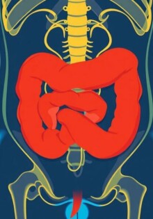 Alfabetización en salud y comprensión de la apendicitis: lo que toda persona debe saber
