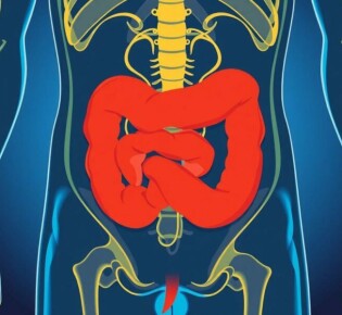Alfabetización en salud y comprensión de la apendicitis: lo que toda persona debe saber