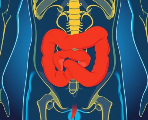 Alfabetización en salud y comprensión de la apendicitis: lo que toda persona debe saber