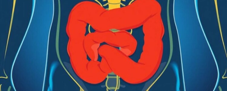 Alfabetización en salud y comprensión de la apendicitis: lo que toda persona debe saber