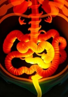 Apendicitis en pacientes con comorbilidades: diabetes, obesidad y más — cómo cambia el diagnóstico y el tratamiento