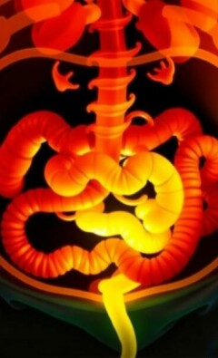 Apendicitis en pacientes con comorbilidades: diabetes, obesidad y más — cómo cambia el diagnóstico y el tratamiento