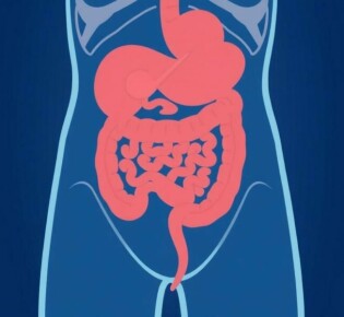 Complications of Untreated Appendicitis: What You Need to Know