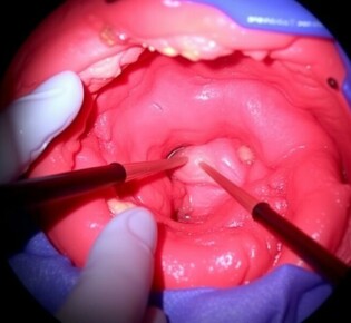 Эндоскопическая резекция слизистой: полный гид для понимания и применения