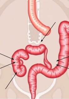 Les signes cliniques classiques de l’appendicite aiguë : reconnaître l’urgence avant qu’il ne soit trop tard