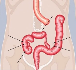Les signes cliniques classiques de l’appendicite aiguë : reconnaître l’urgence avant qu’il ne soit trop tard