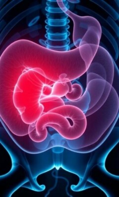 Appendicitis and Artificial Intelligence in Diagnosis: Revolutionizing Emergency Medicine