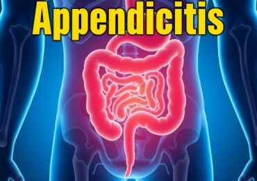 Appendicite : Peut-on en Mourir ?