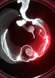 CT Scans for Appendicitis: Understanding the Role of Advanced Imaging in Diagnosis